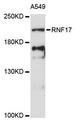 RNF17 Antibody - Western blot analysis of extracts of A-549 cells, using RNF17 antibody at 1:3000 dilution. The secondary antibody used was an HRP Goat Anti-Rabbit IgG (H+L) at 1:10000 dilution. Lysates were loaded 25ug per lane and 3% nonfat dry milk in TBST was used for blocking. An ECL Kit was used for detection and the exposure time was 90s.