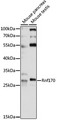 RNF170 Antibody - Western blot analysis of extracts of various cell lines, using Rnf170 antibody at 1:1000 dilution. The secondary antibody used was an HRP Goat Anti-Rabbit IgG (H+L) at 1:10000 dilution. Lysates were loaded 25ug per lane and 3% nonfat dry milk in TBST was used for blocking. An ECL Kit was used for detection and the exposure time was 30s.