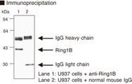 RNF2 / RING2 / RING1B Antibody