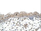 RNF25 Antibody - RNF25 antibody RNF25(ring finger protein 25) Antibody was used in IHC to stain formalin-fixed, paraffin-embedded human skin.  This image was taken for the unconjugated form of this product. Other forms have not been tested.