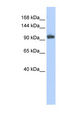 RNF31 Antibody - RNF31 antibody Western blot of Jurkat lysate. This image was taken for the unconjugated form of this product. Other forms have not been tested.