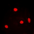 RNF40 / STARING Antibody - Immunofluorescent analysis of RNF40 staining in MCF7 cells. Formalin-fixed cells were permeabilized with 0.1% Triton X-100 in TBS for 5-10 minutes and blocked with 3% BSA-PBS for 30 minutes at room temperature. Cells were probed with the primary antibody in 3% BSA-PBS and incubated overnight at 4 deg C in a humidified chamber. Cells were washed with PBST and incubated with a DyLight 594-conjugated secondary antibody (red) in PBS at room temperature in the dark.