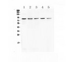RNF43 Antibody - Western blot analysis of RNF43 using anti-RNF43 antibody. Lane 1) HeLa lysates, lane 2) 293T lysates, lane 3) Colo-320 lysates, lane 4) SW620 lysates and lane 5) MCF-7 lysates.