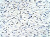 RNF8 Antibody - RNF8 antibody RNF8(ring finger protein 8) Antibody was used in IHC to stain formalin-fixed, paraffin-embedded human heart.  This image was taken for the unconjugated form of this product. Other forms have not been tested.