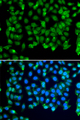 RNF8 Antibody - Immunofluorescence analysis of MCF7 cells.