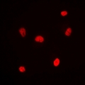 RNF8 Antibody - Immunofluorescent analysis of RNF8 staining in MCF7 cells. Formalin-fixed cells were permeabilized with 0.1% Triton X-100 in TBS for 5-10 minutes and blocked with 3% BSA-PBS for 30 minutes at room temperature. Cells were probed with the primary antibody in 3% BSA-PBS and incubated overnight at 4 deg C in a humidified chamber. Cells were washed with PBST and incubated with a DyLight 594-conjugated secondary antibody (red) in PBS at room temperature in the dark.