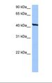 RNFT2 / TMEM118 Antibody - HepG2 cell lysate. Antibody concentration: 0.5 ug/ml. Gel concentration: 12%.  This image was taken for the unconjugated form of this product. Other forms have not been tested.