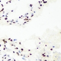 RNGTT / HCAP Antibody - Immunohistochemical analysis of RNGTT staining in mouse lung formalin fixed paraffin embedded tissue section. The section was pre-treated using heat mediated antigen retrieval with sodium citrate buffer (pH 6.0). The section was then incubated with the antibody at room temperature and detected using an HRP conjugated compact polymer system. DAB was used as the chromogen. The section was then counterstained with hematoxylin and mounted with DPX.