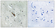 ROBO2 Antibody - Immunohistochemistry analysis of paraffin-embedded human brain tissue, using ROBO2 Antibody. The picture on the right is blocked with the synthesized peptide.