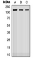ROBO2 Antibody - Western blot analysis of ROBO2 expression in HEK293T (A); Raw264.7 (B); H9C2 (C) whole cell lysates.