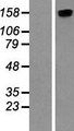 ROCK2 Protein - Western validation with an anti-DDK antibody * L: Control HEK293 lysate R: Over-expression lysate
