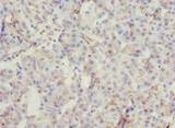 ROGDI Antibody - Immunohistochemistry of paraffin-embedded human pancreatic tissue using antibody at dilution of 1:100.