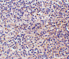 RP105 / CD180 Antibody - Immunohistochemistry of RP105 in human spleen tissue withRP105 antibody at 10 ug/ml.
