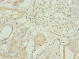 RP2 Antibody - Immunohistochemistry of paraffin-embedded human kidney tissue at dilution 1:100
