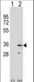 RPA2 / RFA2 / RPA34 Antibody - Western blot of RPA2 (arrow) using rabbit polyclonal RPA2 Antibody. 293 cell lysates (2 ug/lane) either nontransfected (Lane 1) or transiently transfected (Lane 2) with the RPA2 gene.