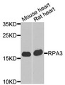 RPA3 Antibody - Western blot analysis of extracts of various cells.