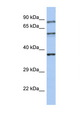 RPH3A / Rabphilin 3A Antibody - RPH3A / Rabphilin 3A antibody Western blot of Small Intestine lysate. Antibody concentration 1 ug/ml. This image was taken for the unconjugated form of this product. Other forms have not been tested.