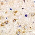 RPH3A / Rabphilin 3A Antibody - Immunohistochemical analysis of Rabphilin 3A staining in human brain formalin fixed paraffin embedded tissue section. The section was pre-treated using heat mediated antigen retrieval with sodium citrate buffer (pH 6.0). The section was then incubated with the antibody at room temperature and detected using an HRP conjugated compact polymer system. DAB was used as the chromogen. The section was then counterstained with hematoxylin and mounted with DPX.