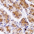 RPH3AL Antibody - Immunohistochemical analysis of Rabphilin-3AL staining in human stomach formalin fixed paraffin embedded tissue section. The section was pre-treated using heat mediated antigen retrieval with sodium citrate buffer (pH 6.0). The section was then incubated with the antibody at room temperature and detected using an HRP conjugated compact polymer system. DAB was used as the chromogen. The section was then counterstained with hematoxylin and mounted with DPX.