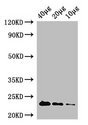 RPIA / RPI Antibody - Western Blot Positive WB detected in: Rosseta bacteria lysate at 40µg, 20µg, 10µg All lanes: rpiA antibody at 1µg/ml Secondary Goat polyclonal to rabbit IgG at 1/50000 dilution Predicted band size: 23 kDa Observed band size: 23 kDa
