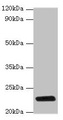 RPIA / RPI Antibody - Western blot All lanes: rpiA antibody at 2µg/ml + DH5a whole cell lysate Secondary Goat polyclonal to rabbit IgG at 1/10000 dilution Predicted band size: 23 kDa Observed band size: 23 kDa