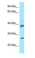 RPL10 / Ribosomal Protein L10 Antibody - RPL10 / L10 antibody Western Blot of Fetal Liver.  This image was taken for the unconjugated form of this product. Other forms have not been tested.