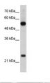 RPL13 / Ribosomal Protein L13 Antibody - HepG2 Cell Lysate.  This image was taken for the unconjugated form of this product. Other forms have not been tested.