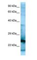 RPL15 / Ribosomal Protein L15 Antibody - RPL15 / L15 antibody Western Blot of HepG2.  This image was taken for the unconjugated form of this product. Other forms have not been tested.