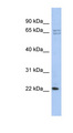 RPL18 / Ribosomal Protein L18 Antibody - RPL18 antibody Western blot of HT1080 cell lysate. This image was taken for the unconjugated form of this product. Other forms have not been tested.