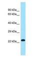 RPL19 / Ribosomal Protein L19 Antibody - RPL19 antibody Western Blot of 293T.  This image was taken for the unconjugated form of this product. Other forms have not been tested.