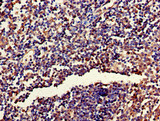 RPL19 / Ribosomal Protein L19 Antibody - Immunohistochemistry of paraffin-embedded human tonsil tissue using RPL19 Antibody at dilution of 1:100