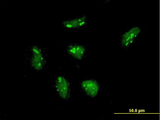 RPL21 / Ribosomal Protein L21 Antibody - Immunofluorescence of monoclonal antibody to RPL21 on HeLa cell . [antibody concentration 10 ug/ml]