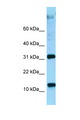 RPL22 / Ribosomal Protein L22 Antibody - RPL22 antibody Western blot of Placenta lysate. Antibody concentration 1 ug/ml.  This image was taken for the unconjugated form of this product. Other forms have not been tested.