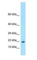 RPL26 / Ribosomal Protein L26 Antibody - RPL26 / L26 antibody Western Blot of Mouse Pancreas.  This image was taken for the unconjugated form of this product. Other forms have not been tested.