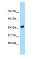 RPL27 / Ribosomal Protein L27 Antibody - RPL27 / L27 antibody Western Blot of Mouse Liver.  This image was taken for the unconjugated form of this product. Other forms have not been tested.