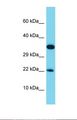 RPL28 / Ribosomal Protein L28 Antibody - Western blot of Human HCT15. RPL28 antibody dilution 1.0 ug/ml.  This image was taken for the unconjugated form of this product. Other forms have not been tested.