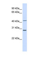 RPL3 / Ribosomal Protein L3 Antibody - RPL3 antibody Western blot of Placenta lysate. This image was taken for the unconjugated form of this product. Other forms have not been tested.