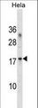 RPL36A / Ribosomal Protein L36 Antibody - RPL36A Antibody western blot of HeLa cell line lysates (35 ug/lane). The RPL36A antibody detected the RPL36A protein (arrow).