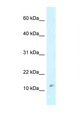 RPL37 / Ribosomal Protein L37 Antibody - RPL37 antibody Western blot of MCF7 Cell lysate. Antibody concentration 1 ug/ml.  This image was taken for the unconjugated form of this product. Other forms have not been tested.