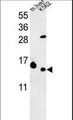 RPL37 / Ribosomal Protein L37 Antibody - RPL37 Antibody western blot of K562 cell line and mouse liver tissue lysates (35 ug/lane). The RPL37 antibody detected the RPL37 protein (arrow).