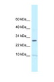 RPL39 / Ribosomal Protein L39 Antibody - RPL39 antibody Western blot of Fetal Brain lysate. Antibody concentration 1 ug/ml.  This image was taken for the unconjugated form of this product. Other forms have not been tested.