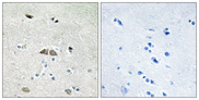 RPL39L Antibody - Immunohistochemistry analysis of paraffin-embedded human brain, using RPL39L Antibody. The picture on the right is blocked with the synthesized peptide.