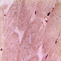RPL3L Antibody - Immunohistochemical analysis of RPL3L staining in human muscle formalin fixed paraffin embedded tissue section. The section was pre-treated using heat mediated antigen retrieval with sodium citrate buffer (pH 6.0). The section was then incubated with the antibody at room temperature and detected using an HRP conjugated compact polymer system. DAB was used as the chromogen. The section was then counterstained with hematoxylin and mounted with DPX. w
