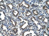 RPL8 / Ribosomal Protein L8 Antibody - RPL8 antibody ARP40215_T100-NP_000964-RPL8(ribosomal protein L8) Antibody was used in IHC to stain formalin-fixed, paraffin-embedded human lung.  This image was taken for the unconjugated form of this product. Other forms have not been tested.