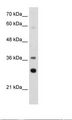 RPLP0 Antibody - Jurkat Cell Lysate.  This image was taken for the unconjugated form of this product. Other forms have not been tested.
