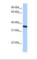 RPLP0 Antibody - HepG2 cell lysate. Antibody concentration: 0.5 ug/ml. Gel concentration: 12%.  This image was taken for the unconjugated form of this product. Other forms have not been tested.