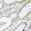 RPN2 / Ribophorin II Antibody - Immunohistochemistry of paraffin-embedded human stomach using RPN2 antibody at dilution of 1:100 (40x lens).