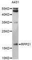 RPP21 Antibody - Western blot analysis of extracts of A431 cells, using RPP21 antibody at 1:3000 dilution. The secondary antibody used was an HRP Goat Anti-Rabbit IgG (H+L) at 1:10000 dilution. Lysates were loaded 25ug per lane and 3% nonfat dry milk in TBST was used for blocking. An ECL Kit was used for detection and the exposure time was 15s.
