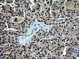 RPRD1B Antibody - IHC of paraffin-embedded Human thyroid tissue using anti-RPRD1B mouse monoclonal antibody. (Heat-induced epitope retrieval by 1 mM EDTA in 10mM Tris, pH8.5, 120°C for 3min).
