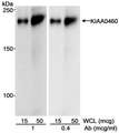 RPRD2 Antibody - Detection of Human KIAA0460 by Western Blot. Samples: Whole cell lysate (15 and 50 ug) from HEK293 cells. Antibody: Affinity purified goat anti-KIAA0460 antibody used at 1 and 0.4 ug/ml. Detection: Chemiluminescence with an exposure time of 1 minute.